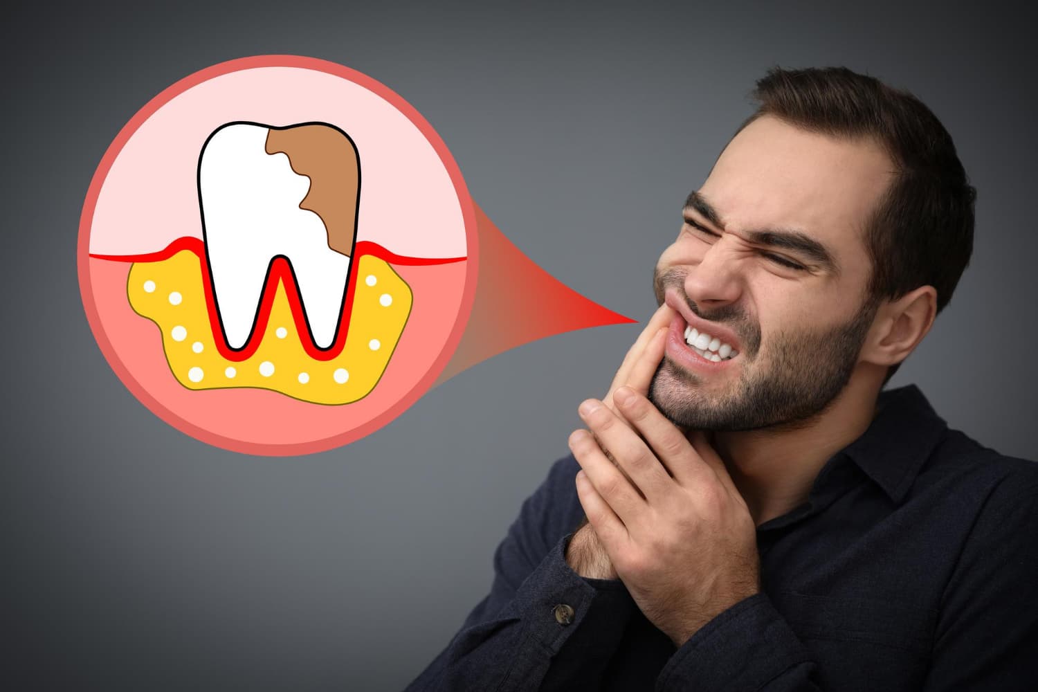 consejos para prevenir la aparición de caries